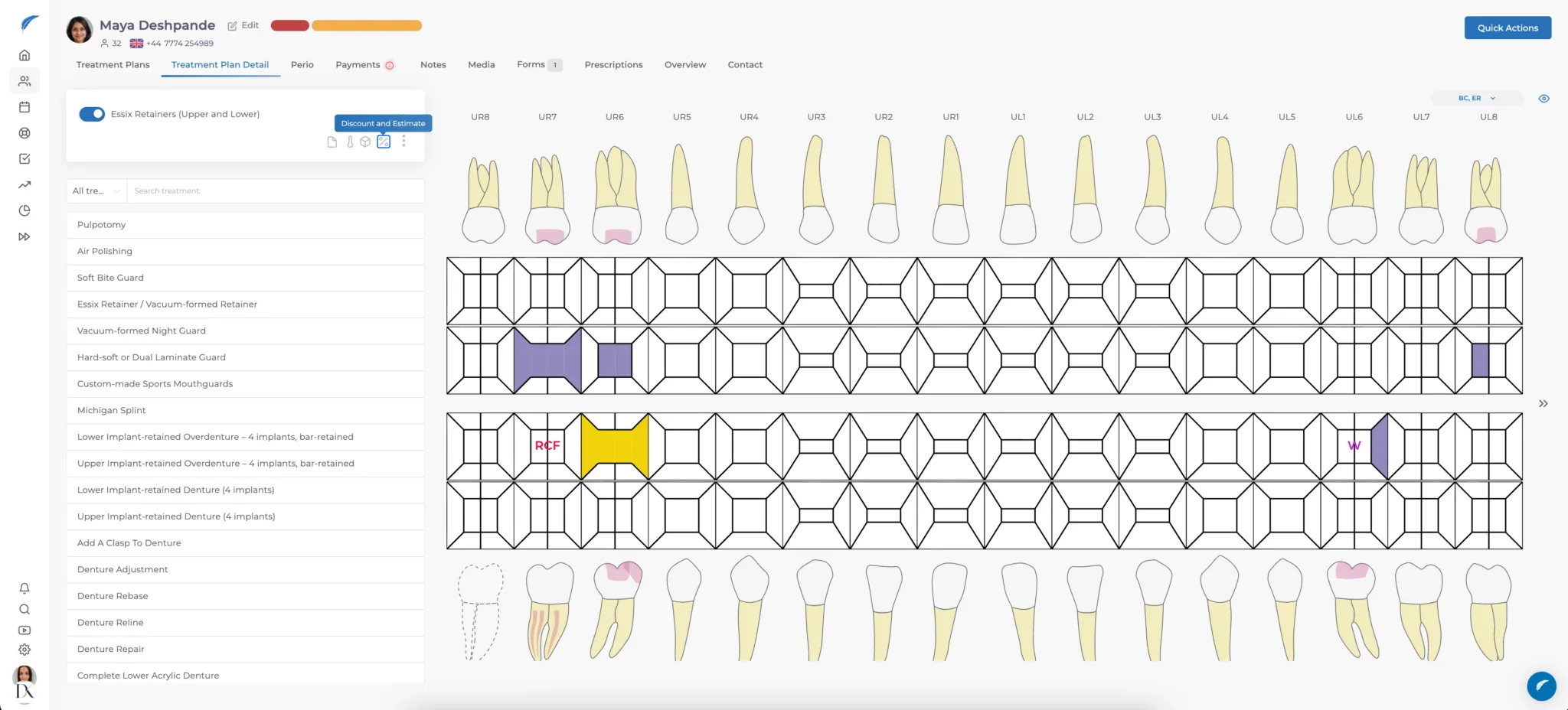 Medicasimple Treatment Plan Detail page showing the dental chart and Discount and Estimate control for accessing payment notes.